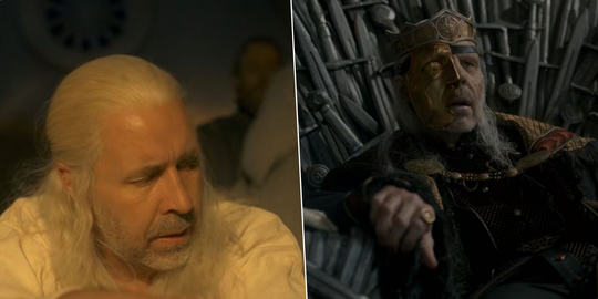 House of the Dragon – how badly did Viserys suffer?